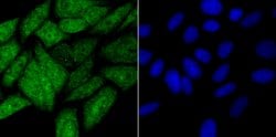 Invitrogen HIF1AN Recombinant Rabbit Monoclonal Antibody (JG37-66) 100