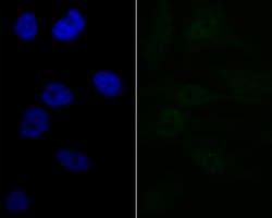 Invitrogen LPIN1 Recombinant Rabbit Monoclonal Antibody (JG37-69) 100 &mu;L;