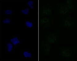 Invitrogen LPIN1 Recombinant Rabbit Monoclonal Antibody (JG37-69) 100 &mu;L;