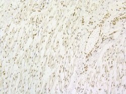 Invitrogen LPIN1 Recombinant Rabbit Monoclonal Antibody (JG37-69) 100 &mu;L;