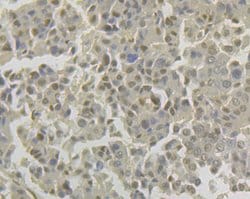 Invitrogen LPIN1 Recombinant Rabbit Monoclonal Antibody (JG37-69) 100 &mu;L;