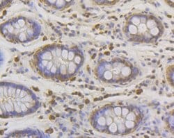 Invitrogen LPIN1 Recombinant Rabbit Monoclonal Antibody (JG37-69) 100 &mu;L;