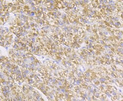 Invitrogen P2Y6 Recombinant Rabbit Monoclonal Antibody (JG37-77) 100 &mu;L;