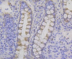 Invitrogen P2Y6 Recombinant Rabbit Monoclonal Antibody (JG37-77) 100 &mu;L;