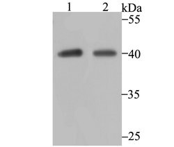 Invitrogen P2Y6 Recombinant Rabbit Monoclonal Antibody (JG37-77) 100 &mu;L;