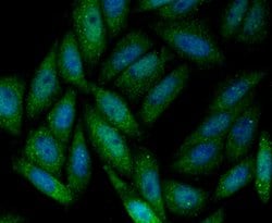 Invitrogen SENP1 Recombinant Rabbit Monoclonal Antibody (JG37-79) 100 &mu;L;