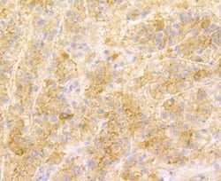Invitrogen SENP1 Recombinant Rabbit Monoclonal Antibody (JG37-79) 100 &mu;L;