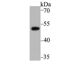 Invitrogen PICK1 Recombinant Rabbit Monoclonal Antibody (JG30-80) 100 &mu;L;