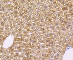 Invitrogen Alcohol Dehydrogenase 1A Recombinant Rabbit Monoclonal Antibody