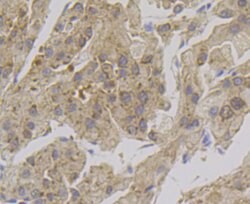 Invitrogen Alcohol Dehydrogenase 1A Recombinant Rabbit Monoclonal Antibody