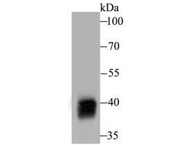 Invitrogen Alcohol Dehydrogenase 1A Recombinant Rabbit Monoclonal Antibody