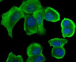 Invitrogen STUB1 Recombinant Rabbit Monoclonal Antibody (JG38-22) 100 &mu;L;
