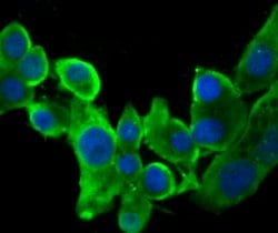 Invitrogen STUB1 Recombinant Rabbit Monoclonal Antibody (JG38-22) 100 &mu;L;
