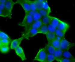 Invitrogen STUB1 Recombinant Rabbit Monoclonal Antibody (JG38-22) 100 &mu;L;