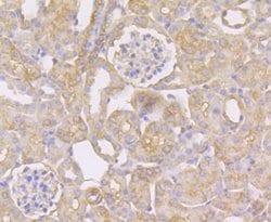 Invitrogen STUB1 Recombinant Rabbit Monoclonal Antibody (JG38-22) 100 &mu;L;