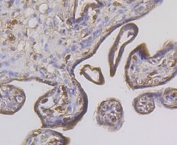 Invitrogen STUB1 Recombinant Rabbit Monoclonal Antibody (JG38-22) 100 &mu;L;