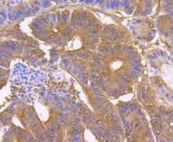 Invitrogen STUB1 Recombinant Rabbit Monoclonal Antibody (JG38-22) 100 &mu;L;