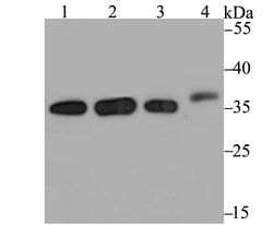 Invitrogen STUB1 Recombinant Rabbit Monoclonal Antibody (JG38-22) 100 &mu;L;
