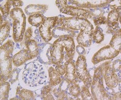 Invitrogen HSPE1 Recombinant Rabbit Monoclonal Antibody (JG82-34) 100 &mu;L;