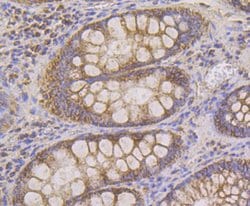 Invitrogen HSPE1 Recombinant Rabbit Monoclonal Antibody (JG82-34) 100 &mu;L;