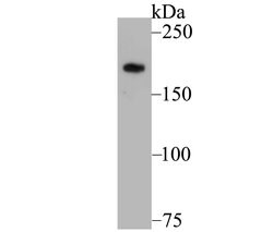 Invitrogen GLI3 Recombinant Rabbit Monoclonal Antibody (JG83-39) 100 &mu;L;