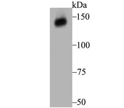 Invitrogen XDH Recombinant Rabbit Monoclonal Antibody (JG38-40) 100 &mu;L | Buy Online | Invitrogen&trade; | Fisher Scientific