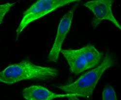 Invitrogen UPF1 Recombinant Rabbit Monoclonal Antibody (JG38-44) 100 &mu;L;