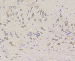 Invitrogen UPF1 Recombinant Rabbit Monoclonal Antibody (JG38-44) 100 &mu;L;