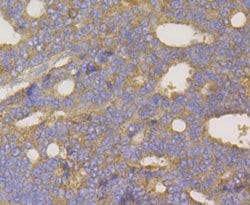 Invitrogen UPF1 Recombinant Rabbit Monoclonal Antibody (JG38-44) 100 &mu;L;
