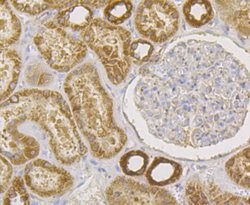 Invitrogen UPF1 Recombinant Rabbit Monoclonal Antibody (JG38-44) 100 &mu;L;