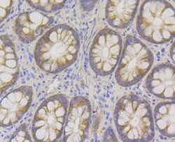 Invitrogen UPF1 Recombinant Rabbit Monoclonal Antibody (JG38-44) 100 &mu;L;