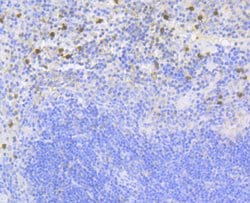 Thermo Scientific NCF2 Recombinant Rabbit Monoclonal Antibody (JG86-31):Antibodies,