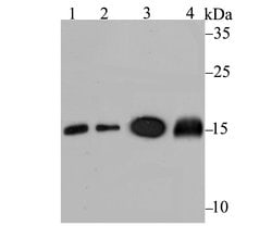 Invitrogen UBC13 Recombinant Rabbit Monoclonal Antibody (JG38-68) 100 &mu;L;