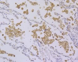 Invitrogen TYROBP Recombinant Rabbit Monoclonal Antibody (JG38-70) 100