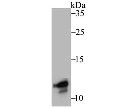 Invitrogen TYROBP Recombinant Rabbit Monoclonal Antibody (JG38-70) 100