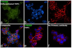 Invitrogen TYROBP Recombinant Rabbit Monoclonal Antibody (JG38-70) 100