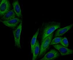 Invitrogen IQGAP1 Recombinant Rabbit Monoclonal Antibody (JG38-74) 100