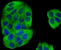 Invitrogen IQGAP1 Recombinant Rabbit Monoclonal Antibody (JG38-74) 100