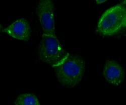 Invitrogen IQGAP1 Recombinant Rabbit Monoclonal Antibody (JG38-74) 100