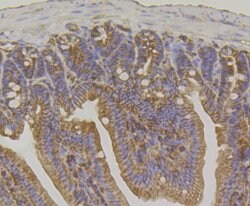 Invitrogen IQGAP1 Recombinant Rabbit Monoclonal Antibody (JG38-74) 100