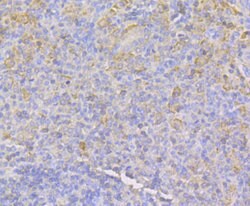 Invitrogen IQGAP1 Recombinant Rabbit Monoclonal Antibody (JG38-74) 100