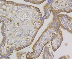 Invitrogen IQGAP1 Recombinant Rabbit Monoclonal Antibody (JG38-74) 100