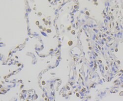 Invitrogen IQGAP1 Recombinant Rabbit Monoclonal Antibody (JG38-74) 100