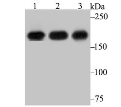 Invitrogen IQGAP1 Recombinant Rabbit Monoclonal Antibody (JG38-74) 100