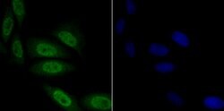 Invitrogen TNPO3 Recombinant Rabbit Monoclonal Antibody (JG38-77) 100 &mu;L;