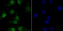 Invitrogen TNPO3 Recombinant Rabbit Monoclonal Antibody (JG38-77) 100 &mu;L;