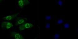 Invitrogen TNPO3 Recombinant Rabbit Monoclonal Antibody (JG38-77) 100 &mu;L;