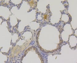 Invitrogen TNPO3 Recombinant Rabbit Monoclonal Antibody (JG38-77) 100 &mu;L;
