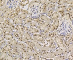 Invitrogen TNPO3 Recombinant Rabbit Monoclonal Antibody (JG38-77) 100 &mu;L;