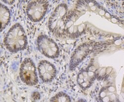 Invitrogen TNPO3 Recombinant Rabbit Monoclonal Antibody (JG38-77) 100 &mu;L;